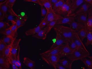 AH-1 ovine trophoblast cell line infected with Parachlamydia acanthamoeba